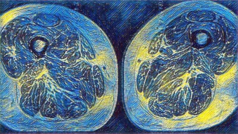 Ультрапереработанные продукты: как они влияют на мышцы и артрит колена