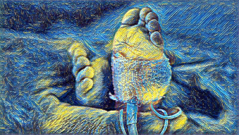 A common plastic toxin may be linked to infant deaths and prematurity, study says